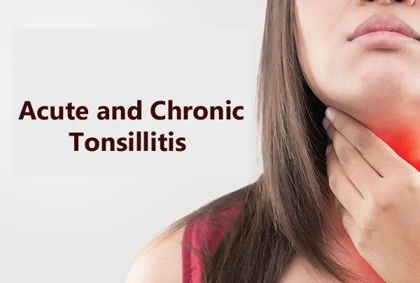 Acute and Chronic Tonsillitis