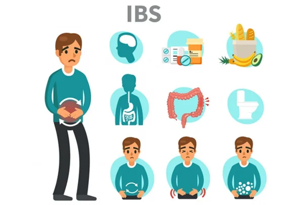 Irritable Bowel Syndrome (IBS)