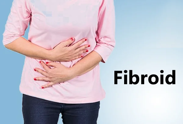 Fibroid