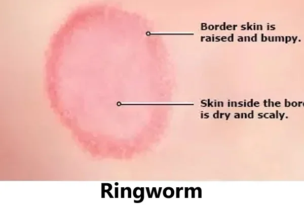 Skin Problems